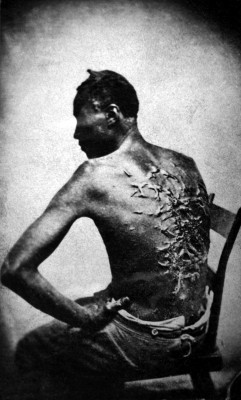 Gordon, a whipped slave, photo taken at Baton Rouge, 1863.